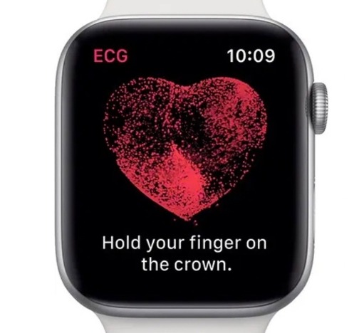 Apple watchの心電図機能が近々利用可能に！